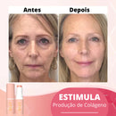 Sérum Removedor de rugas e linhas de expressão